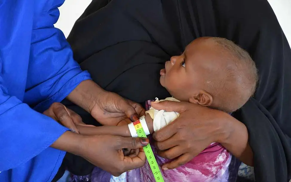 Aziz wird auf Mangelernährung untersucht | © UNICEF/Javier Suarez Argueta Drohende Hungersnot Somalia: Sorgfältige Kontrolle bei mangelernährten Kindern