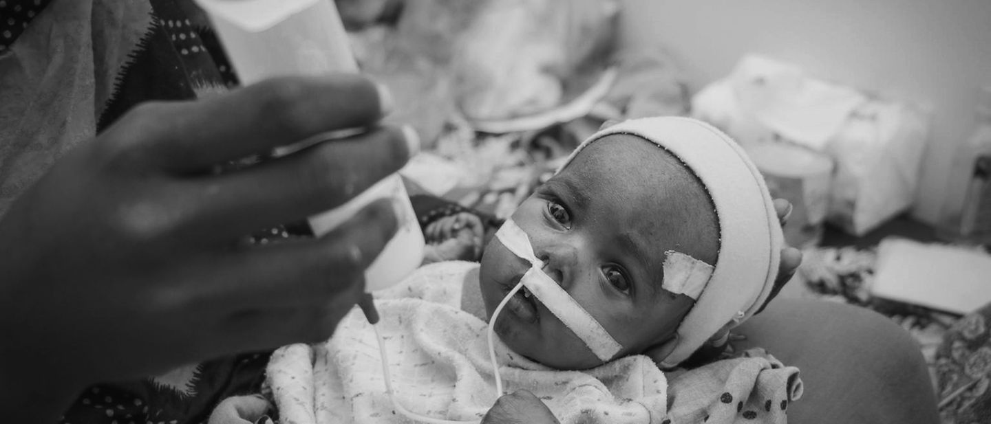 Saleh im Krankenhaus in Aden | © UNICEF/UNI313433 Jemen: Die schwer mangelernährte Saleh bei der Behandlung im Krankenhaus in Aden