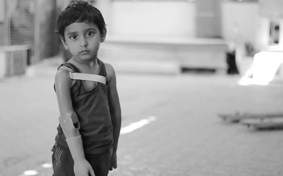 jemen-junge-mit-armprothese-UNI338366 | © UNICEF/Alzekri jemen-junge-mit-armprothese-UNI338366