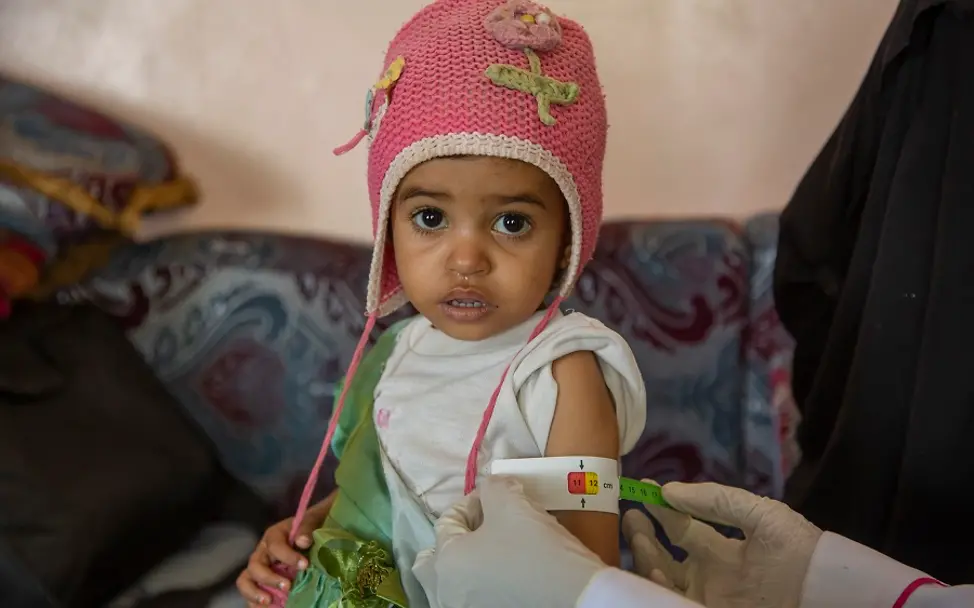 Jemen: Der wachsende Hunger bedroht die Kinder | © UNICEF/Almahbashi Jemen: Mit einem Maßband wird untersucht, wie stark das Mädchen mangelernährt ist.