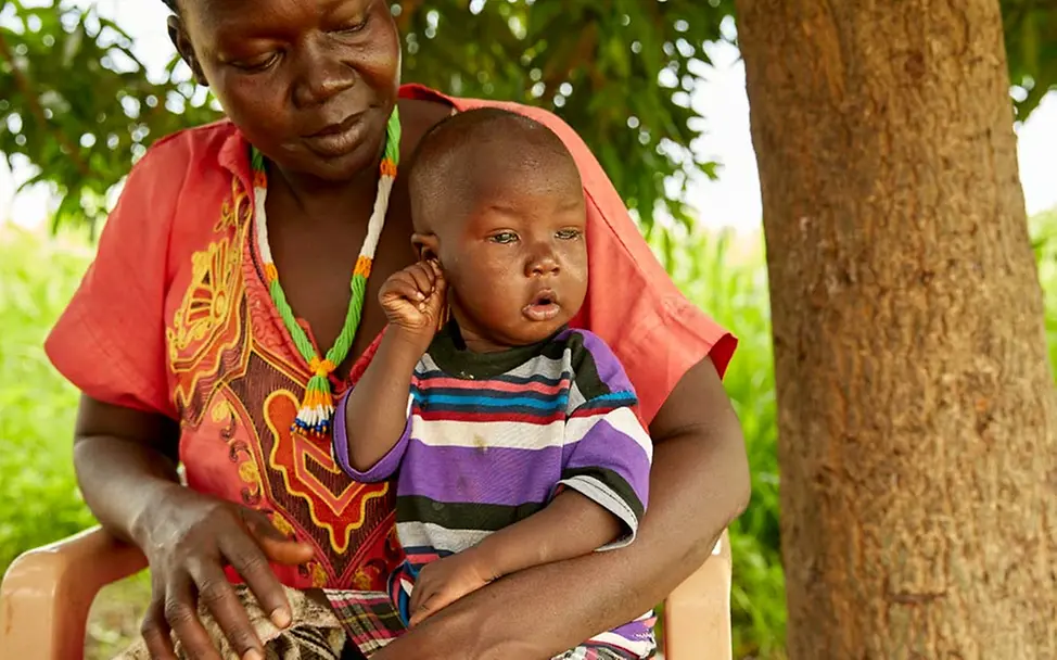 Akot auf dem Schoß seiner Mutter | © UNICEF/Wilson Akot auf dem Schoß seiner Mutter