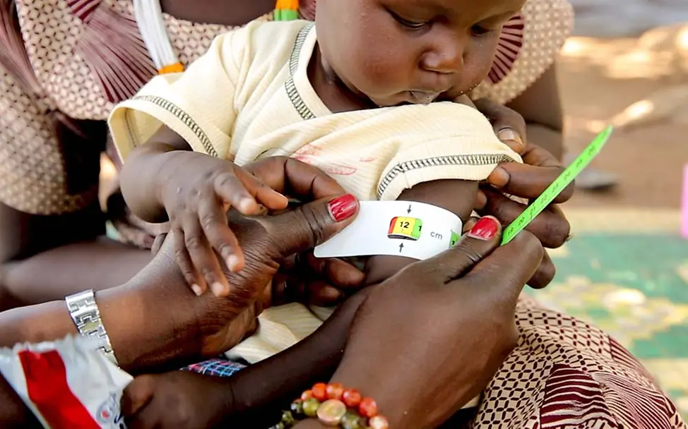 Akots Arm wird mit einem MUAC-Maßband vermesssen. | © UNICEF/Wilson Akots Arm wird mit einem MUAC-Maßband vermessen.