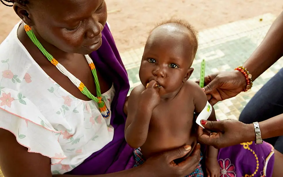 Akots Oberam wird mit einem MUAC-Maßband vermessen. | © UNICEF/Wilson Akots Oberam wird mit einem MUAC-Maßband vermessen.