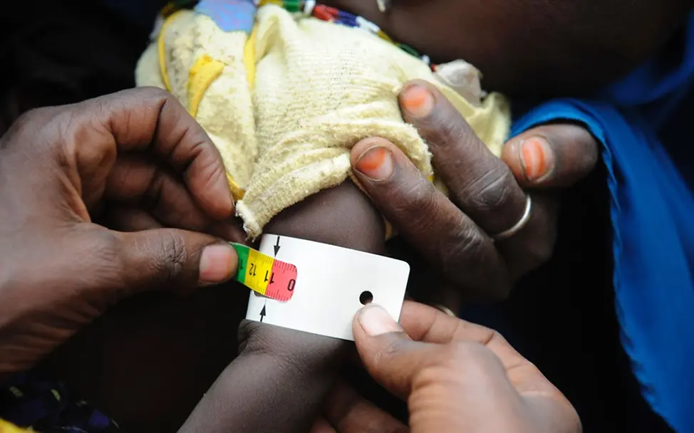 Das UNICEF-Maßband zeigt: schwer mangelernährt | © UNICEF/NYHQ2010-1161/Riccardo Gangale Kenia: Das UNICEF-Maßband zeigt die Mangelernährung