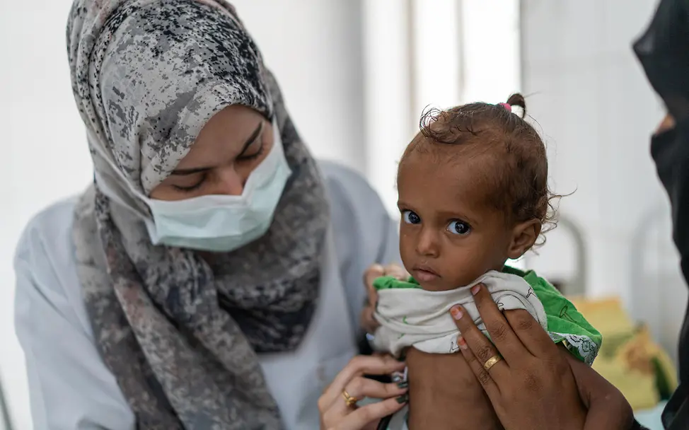 Jemen: Ein mangelernährtes Mädchen wird untersucht | © UNICEF/Hayyan Jemen: Ein mangelernährtes Mädchen wird untersucht