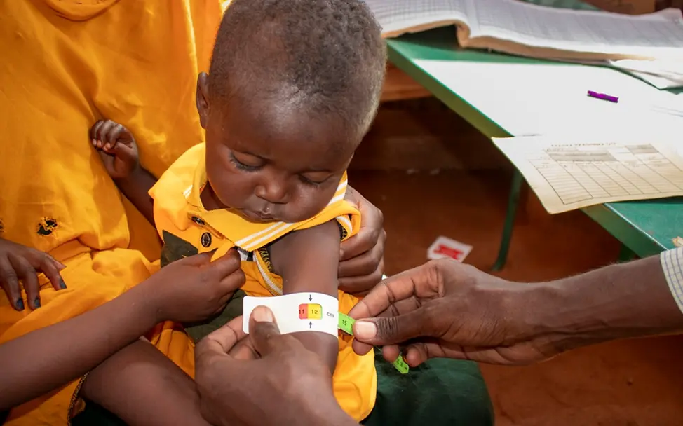 Somalia 2024: Der kleine Sabir wird im Kahary Camp für Binnenvertriebene wegen Mangelernährung behandelt. | © UNICEF/UNI534912/Hill Hochwasser Folgen: Oberarmumfang eines Kleinkindes wird mit MUAC-BAnd gemessen