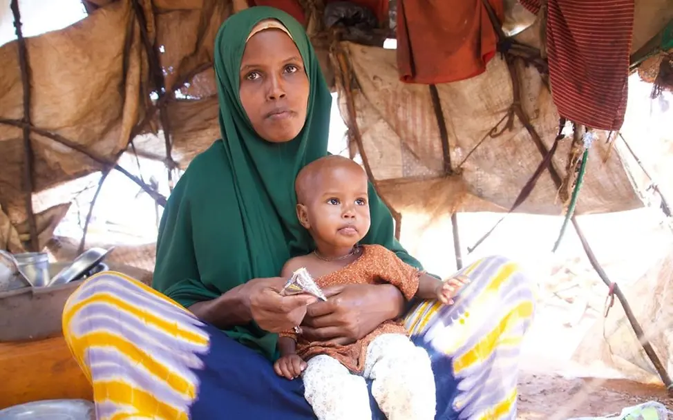 Eine Mutter hält ihr Kind, das von UNICEF gegen Mangelernährung behandelt wird. | © UNICEF/UNICEF Somalia Hunger in Somalia: Eine Mutter hält ihr Kind, das gegen Mangelernährung behandelt wird.