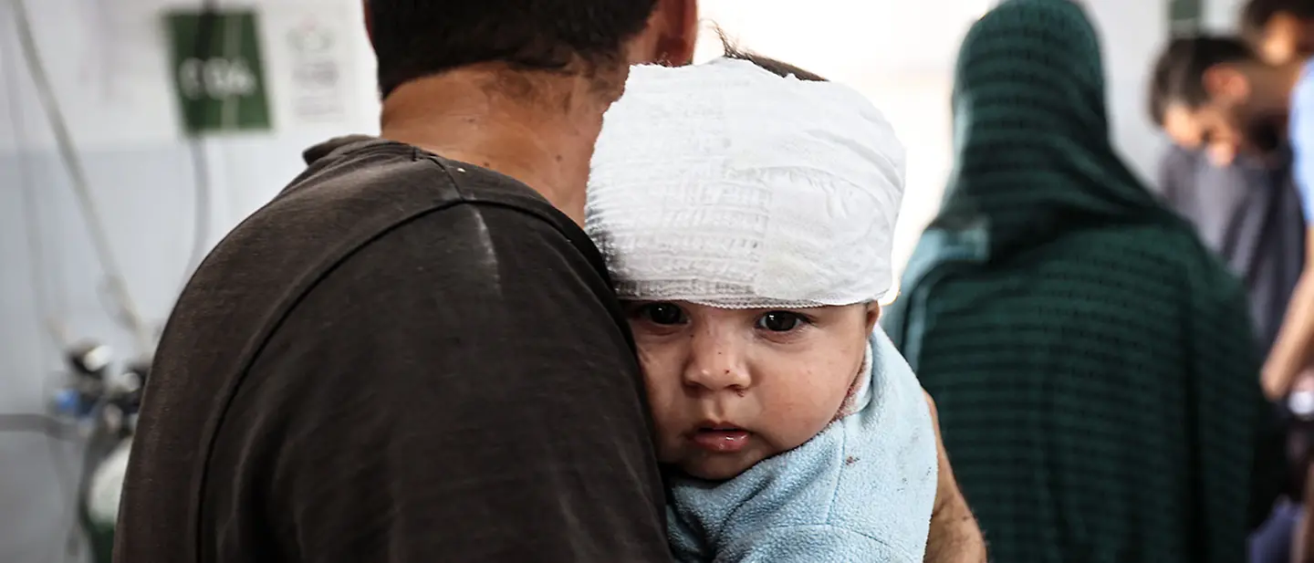 Ein im Gazastreifen bei einem Luftangriff verletztes Baby | © UNICEF/El Baba Gaza spenden: Viele palästinensische Kinder wurden seit Kriegsbeginn getötet und verletzt. Viele leiden Hunger.