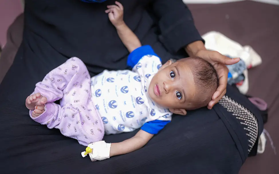 Jemen: Ein unterernährtes Baby im Schoß der Mutter. | © UNICEF/Alaa Noman Jemen: Ein unterernährtes Baby im Schoß der Mutter.