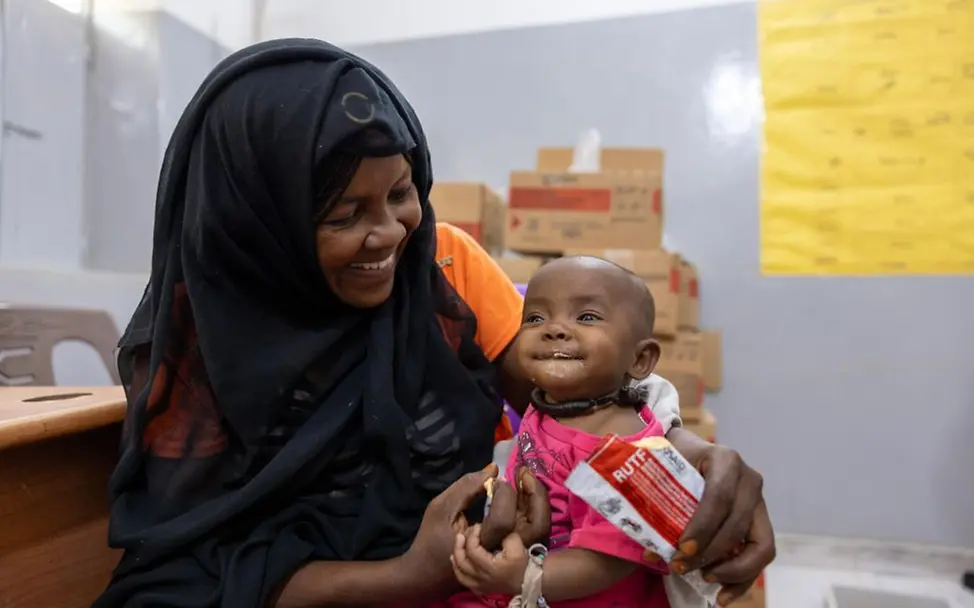 UNICEF sorgt dafür, dass Kinder gegen Mangelernährung behandelt werden. © UNICEF/Dawod UNICEF-Patenschaft: Kinder werden gegen Mangelernährung behandelt.