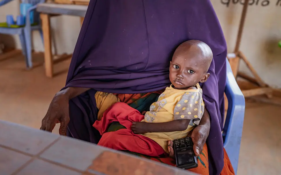 Ein mangelernährtes Kleinkind wird in einem Lager in Somalia behandelt. | © UNICEF/Fadhaye Somalia Hungerkrise: Ein mangelernährtes Kleinkind wartet auf Behandlung.