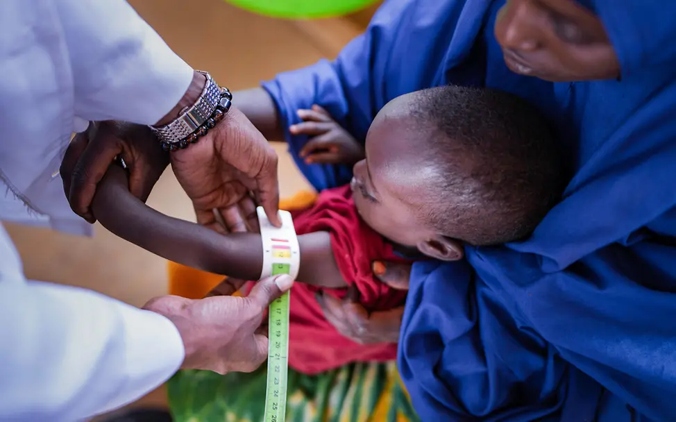 Hunger in Somalia: UNICEF unterstützt Gesundheitszentren, in denen mangelernährten Kindern geholfen wird. | © UNICEF/Fadhaye Hunger in Somalia: Ein Kleinkind wird von einem Helfer auf Mangelernährung untersucht.