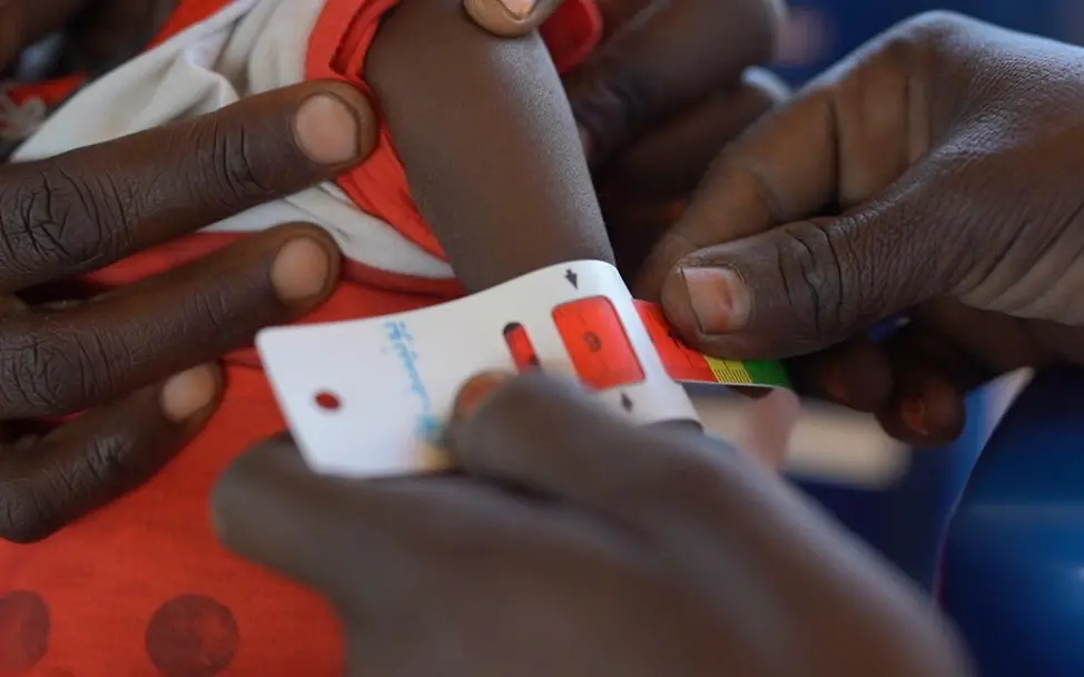 Ein Kind wird auf Mangelernährung untersucht. | © UNICEF/Jamal Ein Kind wird auf Mangelernährung untersucht.