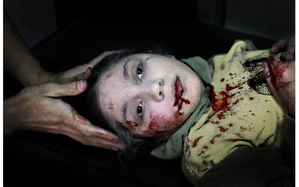 Syrien: Das vergessene Leid der Kinder. © Niclas Hammarström/Kontinent Syrien: Das vergessene Leid der Kinder. © Niclas Hammarström/Kontinent