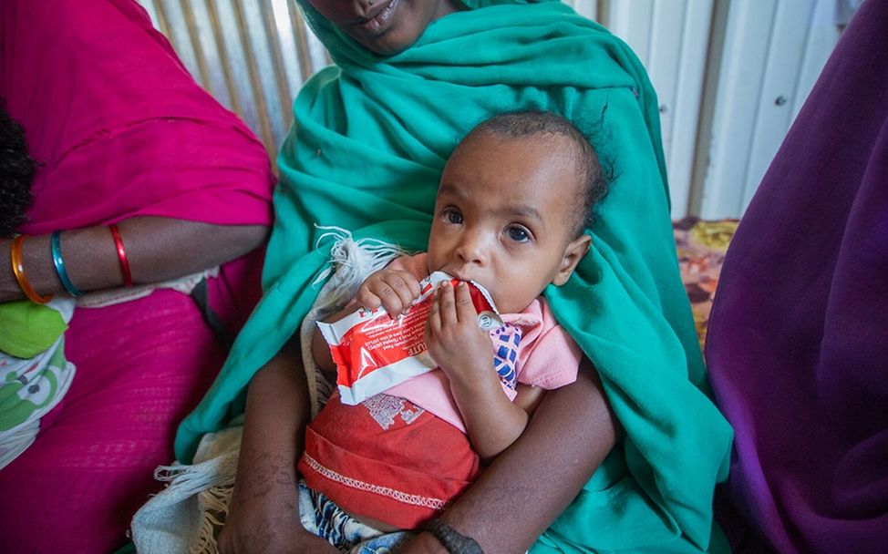 Sudan: Hunger und Mangelernährung
